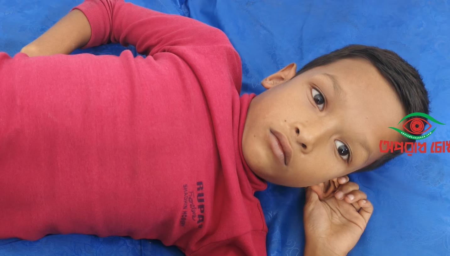 শিয়ালের কামড়ে নারী-শিশুসহ আহত ৩