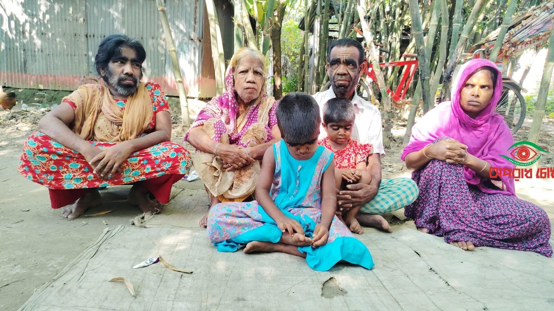 শরীরে প্রাণীদের মত লোম নিয়ে তিনটি পরিবারের মানবেতর জীবন-যাপন